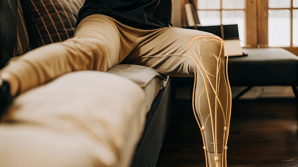 Meralgia Paresthetica Nerve Path An anatomical diagram highlighting the lateral femoral cutaneous nerve and the area on the outer thigh it affects.